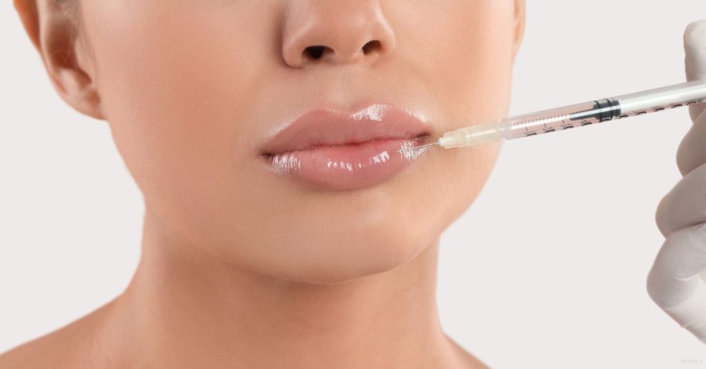 A close-up shot of woman getting a lip filler (MODELS)